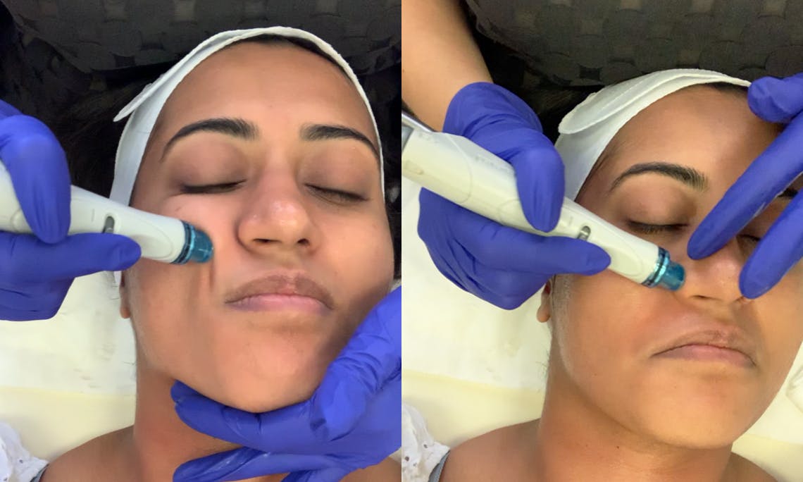 Kingdom Royale Spa Services - hydrafacial